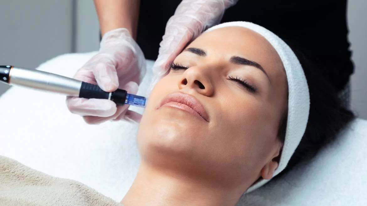 Dermapen İşlemi